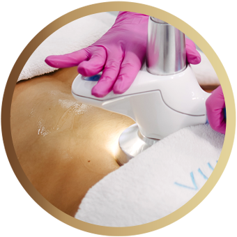 Remodelare corporala